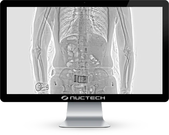 monitor-nuctech-ht3000sv-escaner-de-rayos-x-con-sistema-de-inspeccion-de-cuerpo-humano-2
