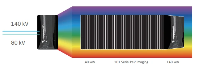 neuviz-ace-graphic-imagen-espectral