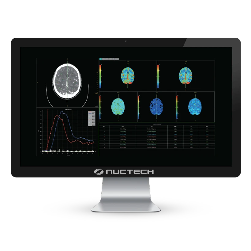 neuviz-ace-up-monitor-06 neuviz-ace-up-monitor-06