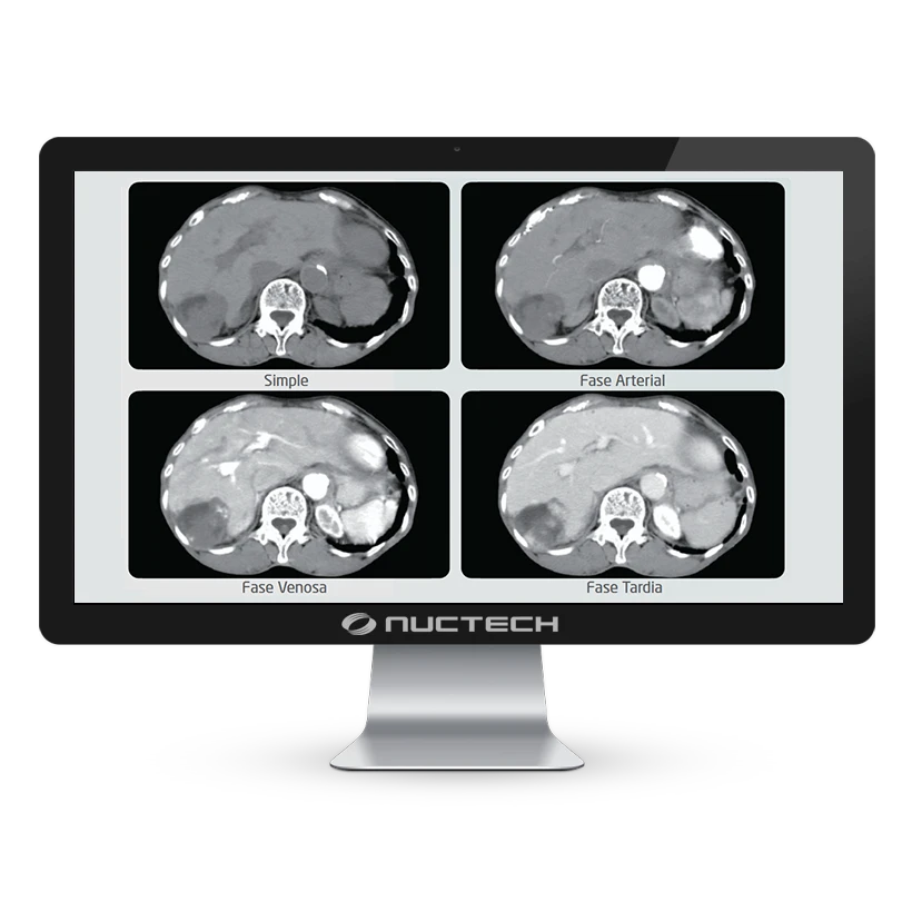 neuviz-ace-up-monitor-abdomen neuviz-ace-up-monitor-abdomen