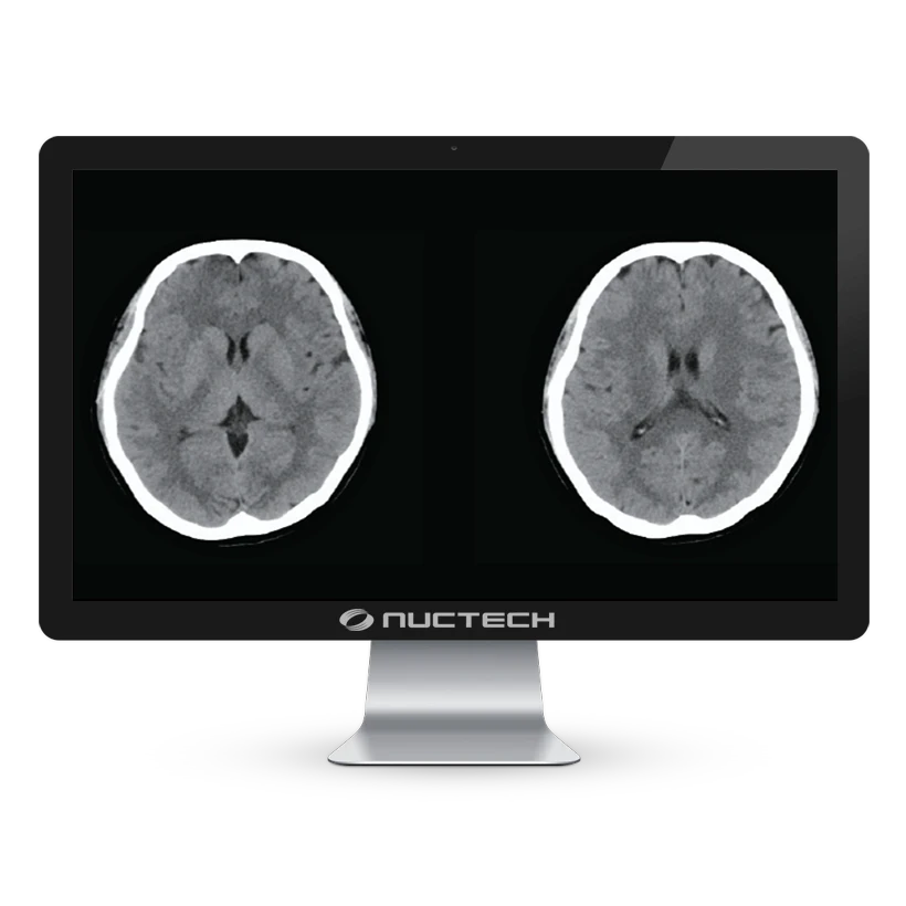 neuviz-ace-up-monitor-cerebro neuviz-ace-up-monitor-cerebro